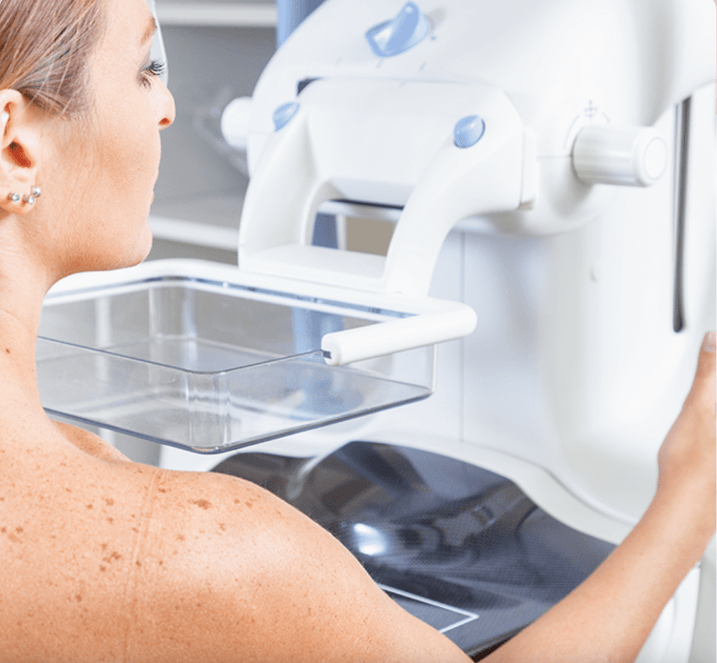 La mammographie : késako&nbsp;?